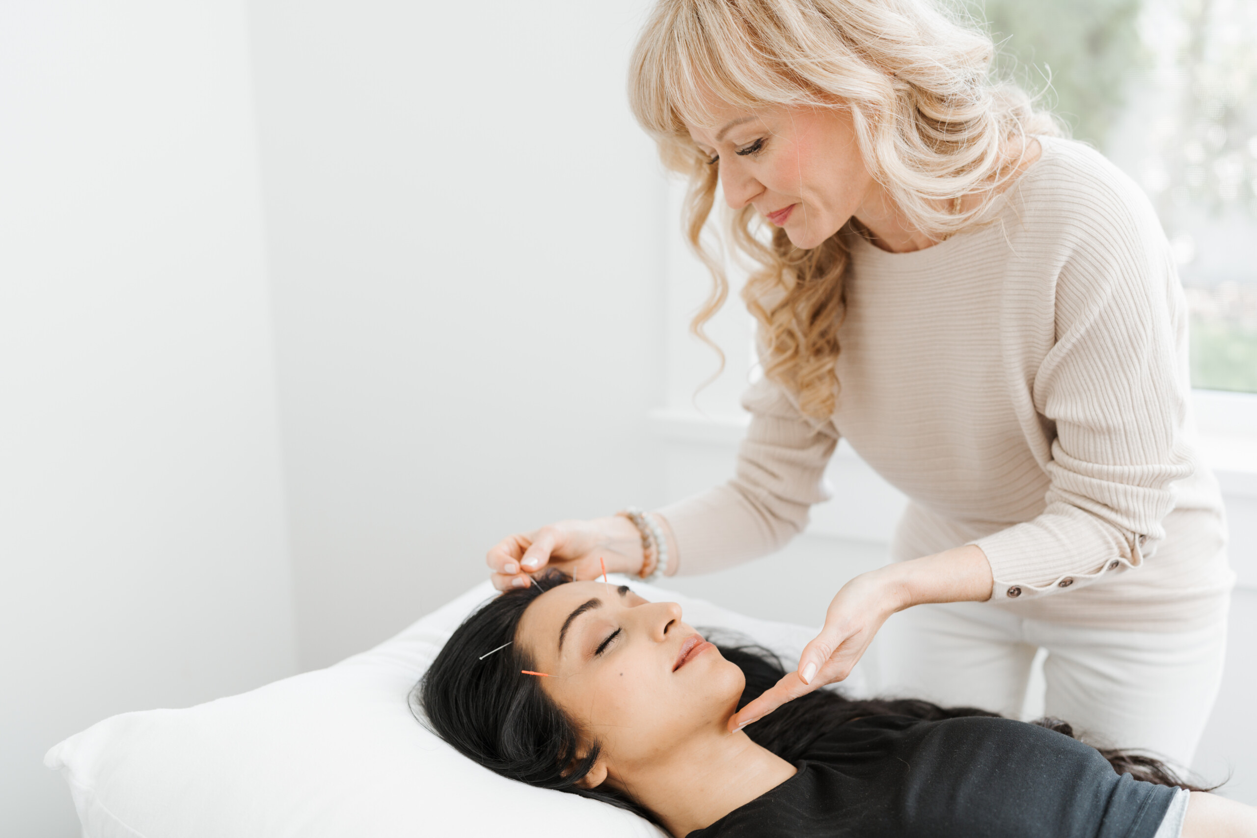 Cosmetic acupuncture treatment